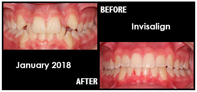 January 2018 Smile of the Month
