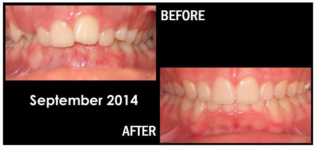 September 2014 Smile of the Month