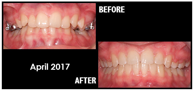 April 2017 Smile of the Month