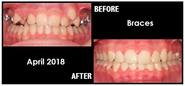 April 2018 Smile of the Month