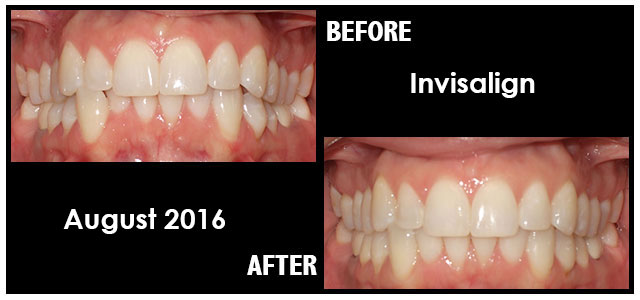 August 2016 Smile of the Month