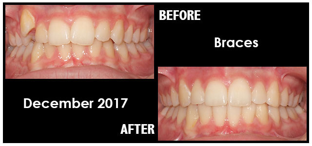 December 2017 Smile of the Month