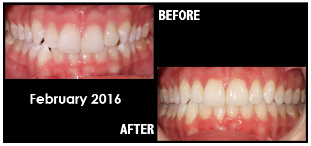February 2016 Smile of the Month