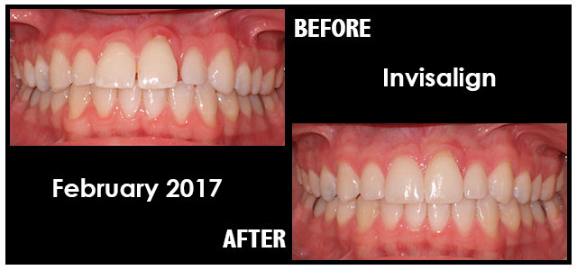 February 2017 Smile of the Month