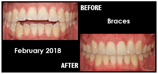 February 2018 Smile of the Month