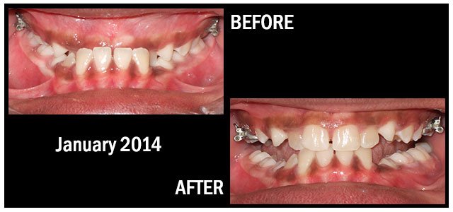 January 2014 Smile of the Month