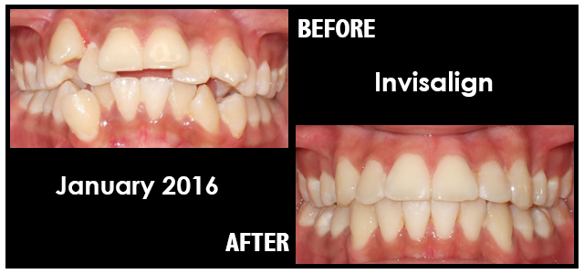 January 2016 Smile of the Month