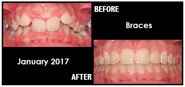 January 2017 Smile of the Month