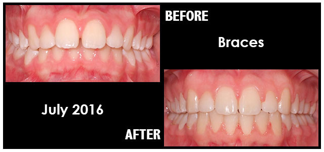 July 2016 Smile of the Month