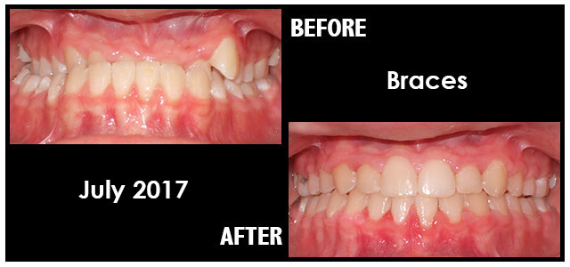 July 2017 Smile of the Month