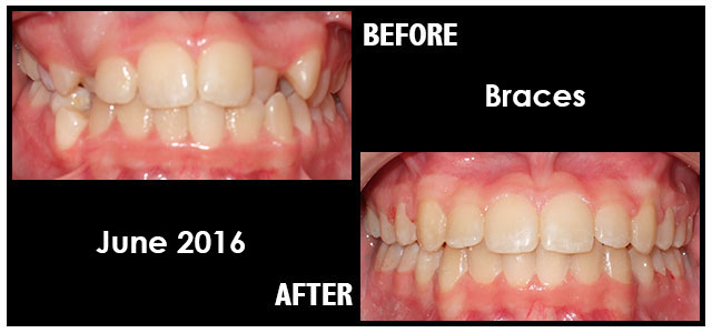 June 2016 Smile of the Month