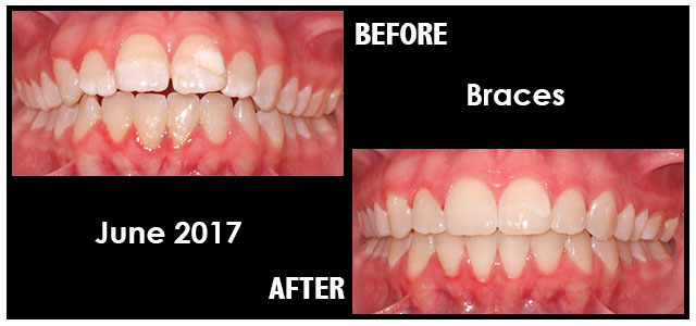 June 2017 Smile of the Month