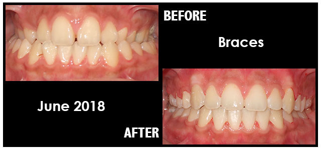 June 2018 Smile of the Month