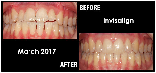 March 2017 Smile of the Month