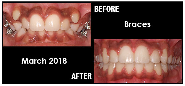 March 2018 Smile of the Month