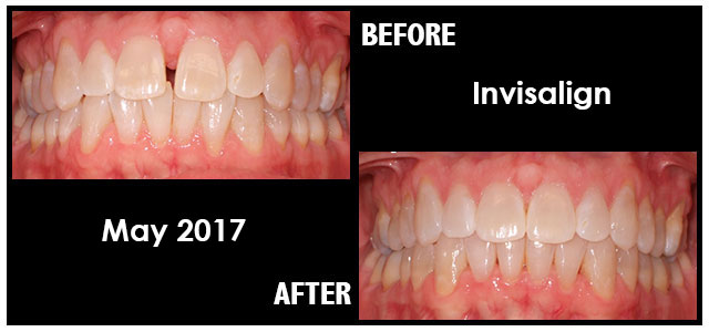May 2017 Smile of the Month