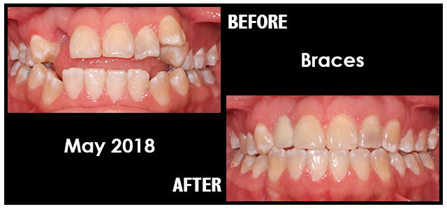 May 2018 Smile of the Month