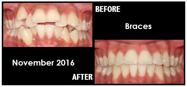 November 2016 Smile of the Month
