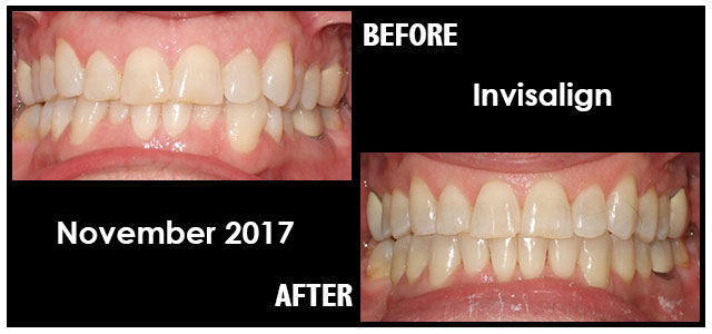 November 2017 Smile of the Month