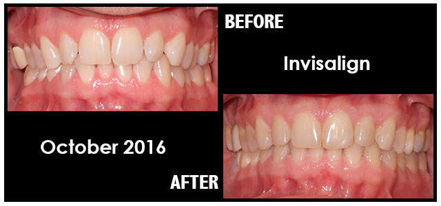 October 2016 Smile of the Month