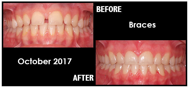 October 2017 Smile of the Month