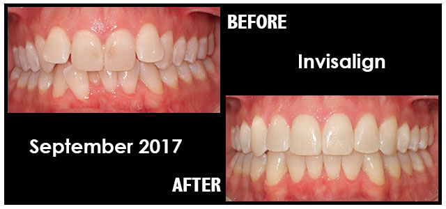 September 2017 Smile of the Month
