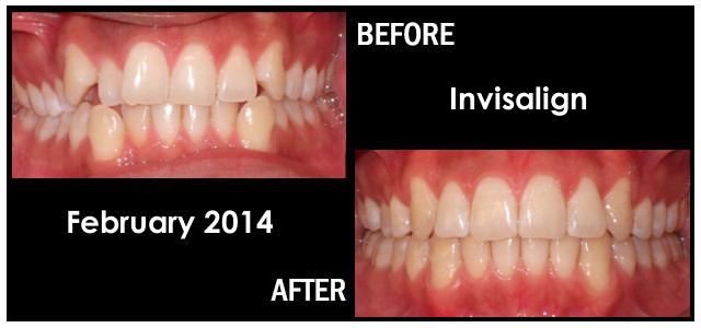 February 2014 Smile of the Month