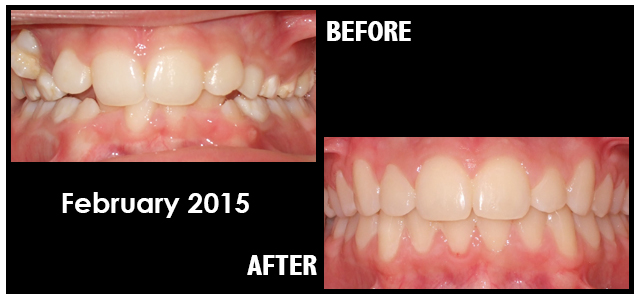February 2015 Smile of the Month