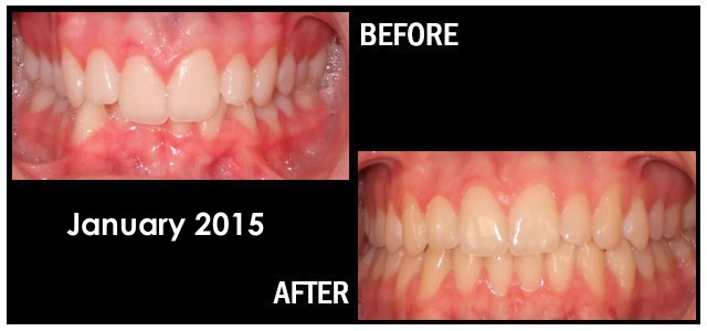 January 2015 Smile of the Month