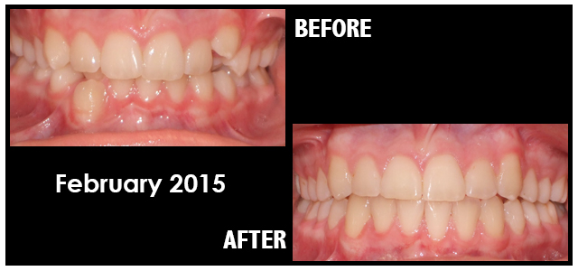 July 2015 Smile of the Month