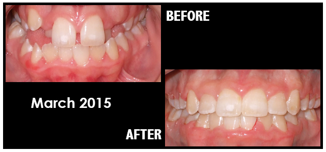 March 2015 Smile of the Month