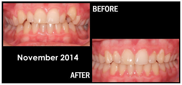 November 2014 Smile of the Month