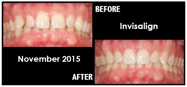 November 2015 Smile of the Month