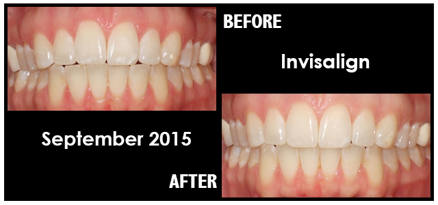 September 2015 Smile of the Month